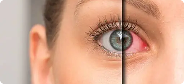 Comprehensive Eye Exams​ in Fargo, ND